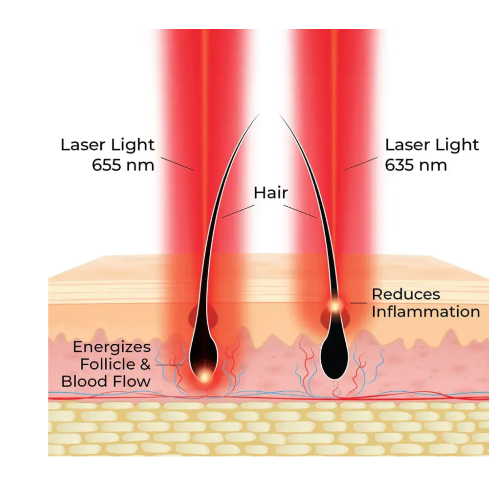 HairMax ACTONIS™ 18 DUAL ACTION LASERCOMB - Laserkamm (Actduo18)