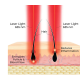 HairMax ACTONIS™ 18 DUAL ACTION LASERCOMB - Laserkamm (Actduo18)