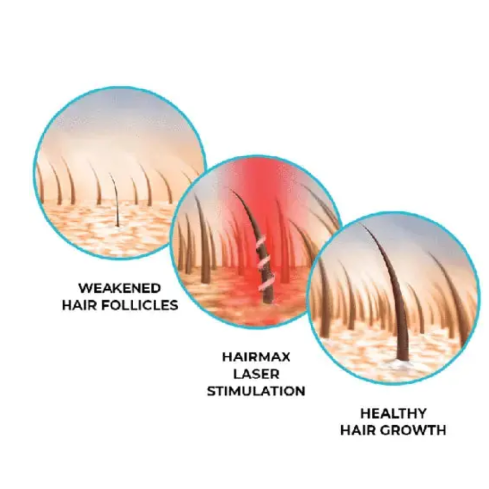 HairMax LaserCap 272 PowerFlex - lasermüts (LASER 272)