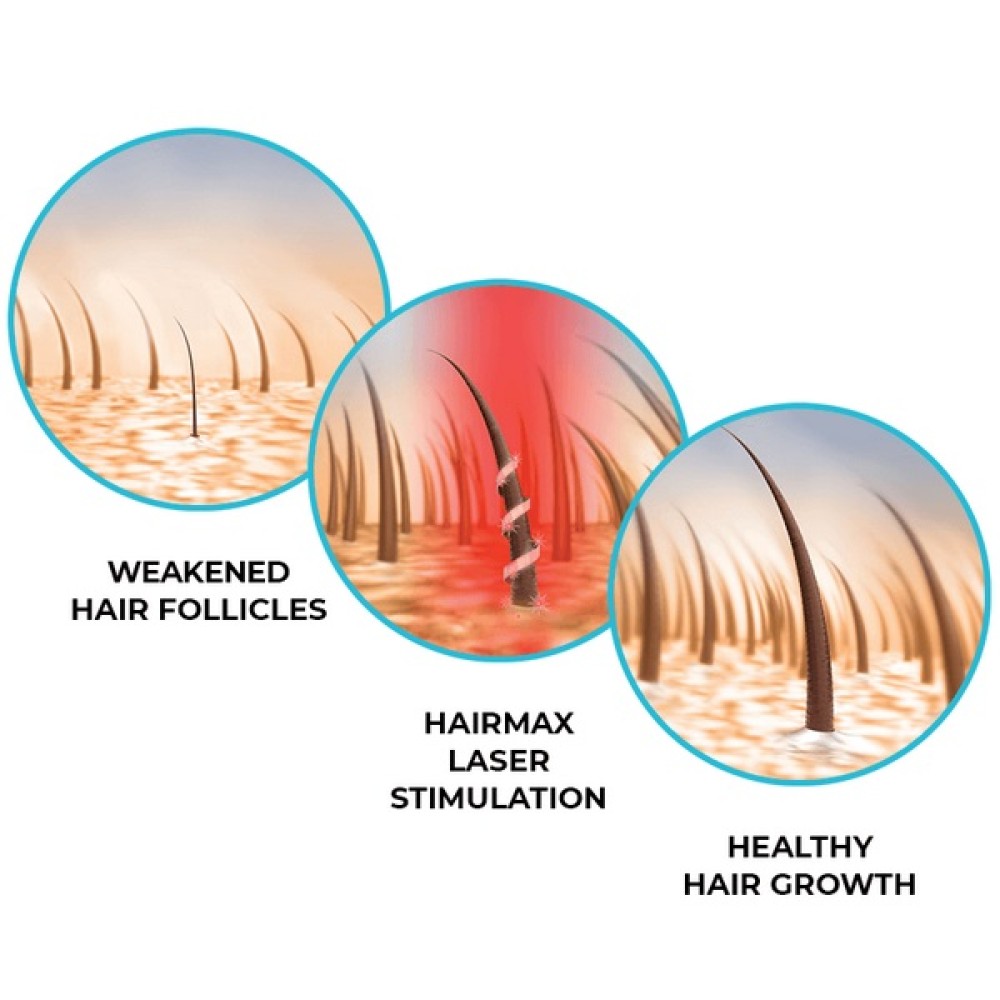 HairMax LaserBand 41 — ComfortFlex laserkamm-riba (16960)