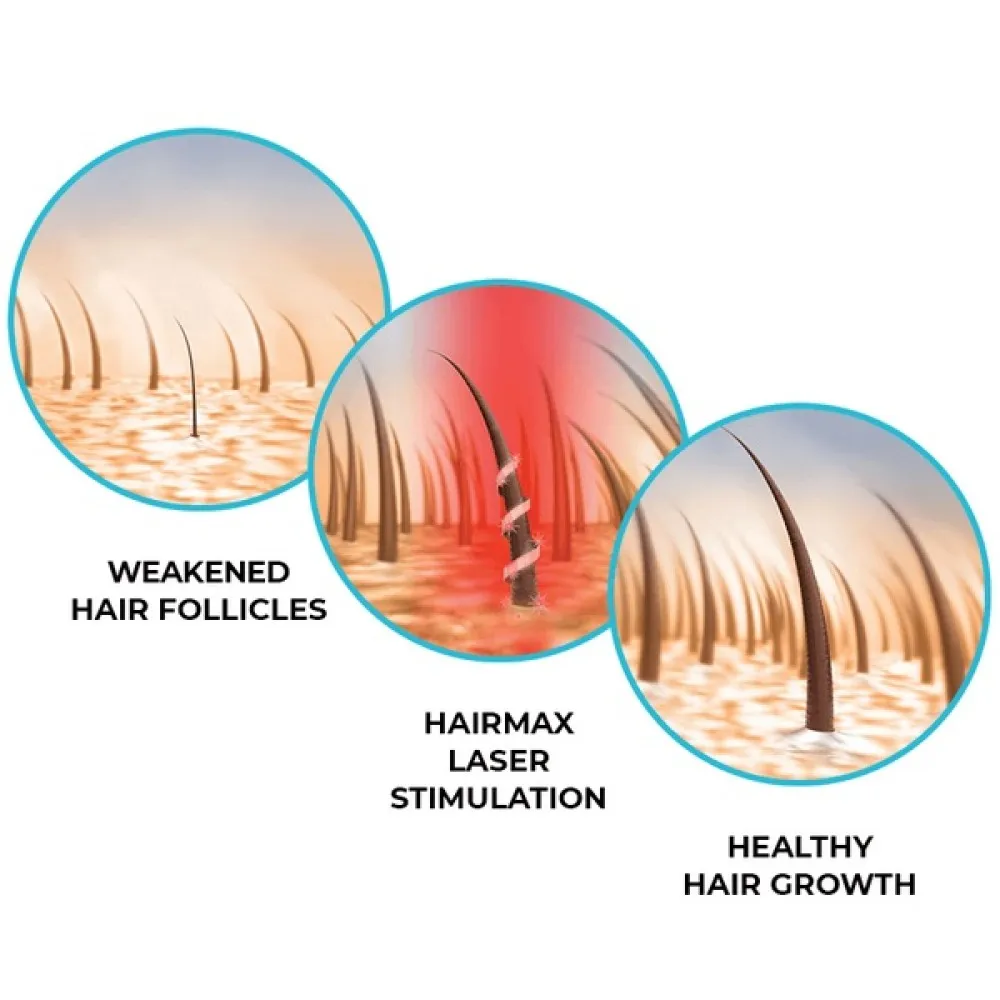 HairMax LaserBand 41 — ComfortFlex laserkamm-riba