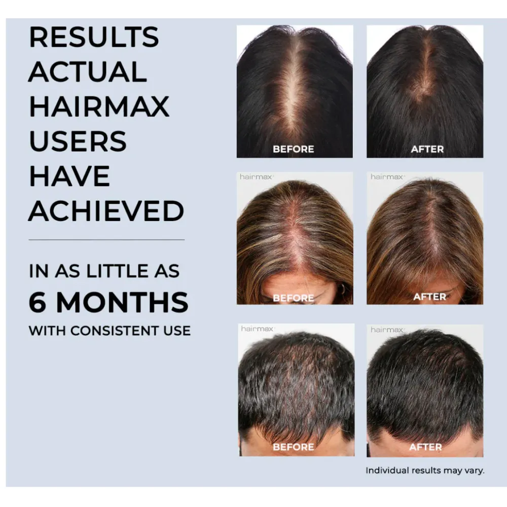 HairMax ACTONIS™ 18 DUAL ACTION LASERCOMB - Laserkamm