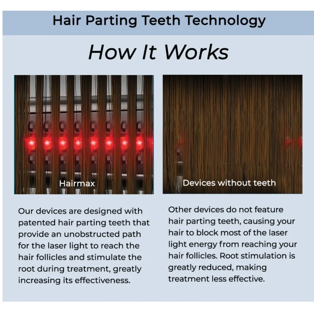 HairMax ACTONIS™ 18 DUAL ACTION LASERCOMB - Laserkamm