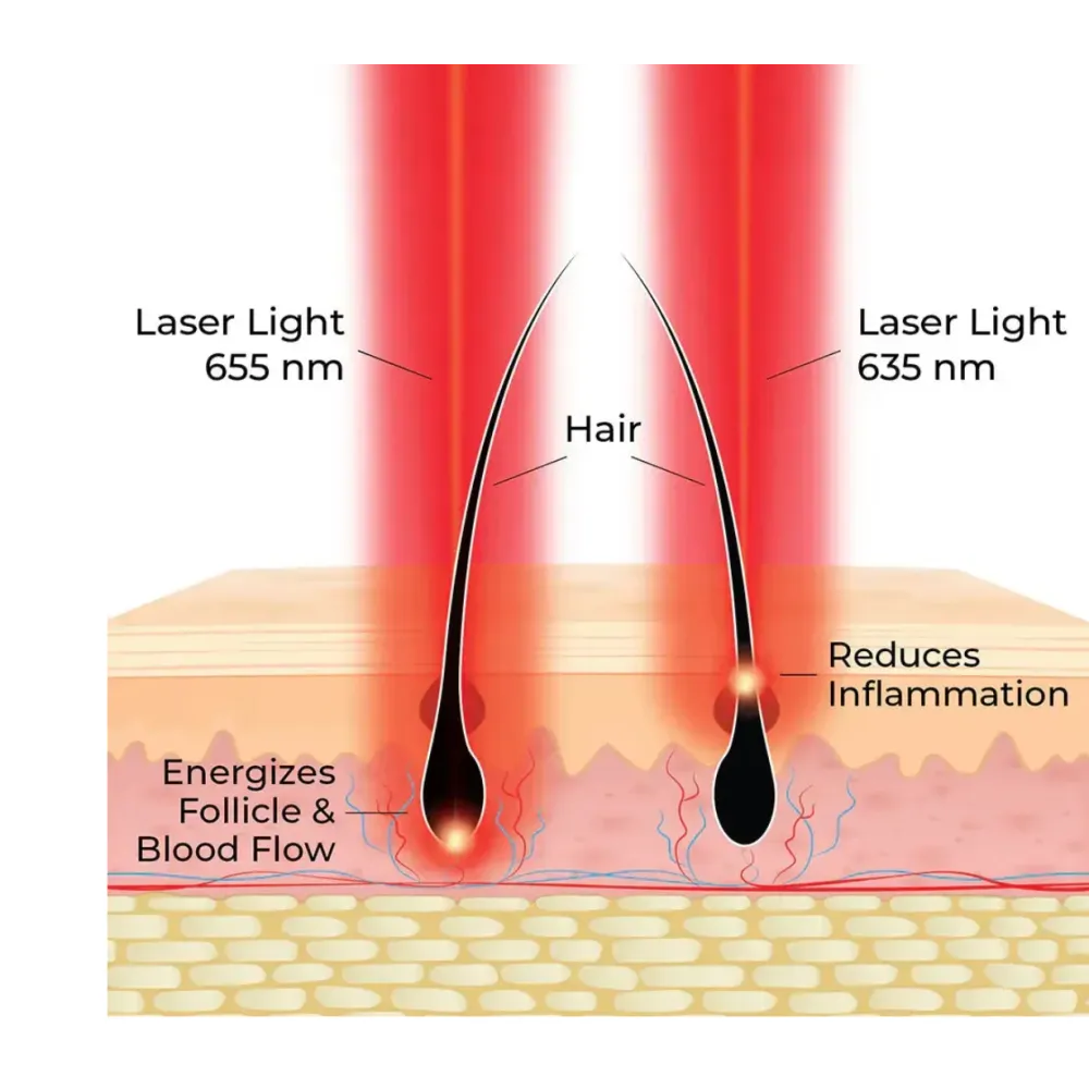 HairMax ACTONIS™ 18 DUAL ACTION LASERCOMB - Laserkamm